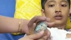 Bocah 12 Tahun di Sukabumi Tewas Diduga Dianiaya Ibu Tirinya, Hasil Visum Ditemukan Luka Bakar