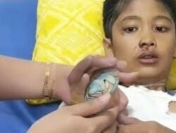 Bocah 12 Tahun di Sukabumi Tewas Diduga Dianiaya Ibu Tirinya, Hasil Visum Ditemukan Luka Bakar